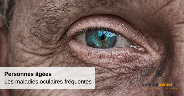 maladies-oculaires-personnes-agées