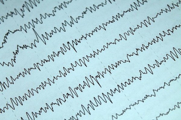 EEG