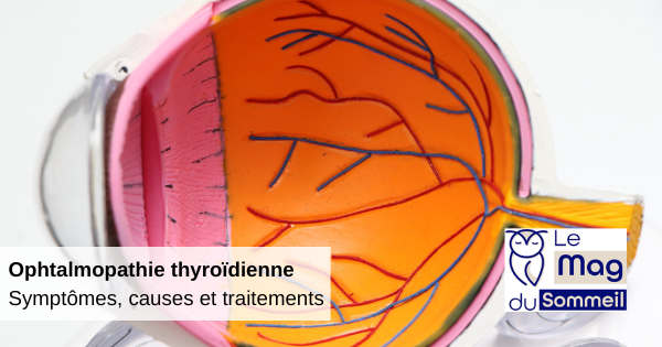 ophtalmoplatie-thyroïdienne